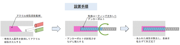 Rアンカーの設置手順